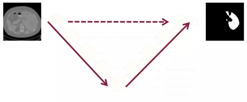 skip connection